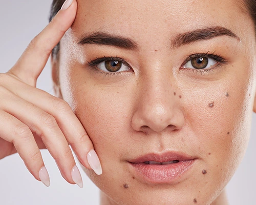 Atténuer durablement les taches pigmentaires et retrouver une peau plus lumineuse.