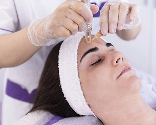 Quels sont les bienfaits du microneedling visage ?